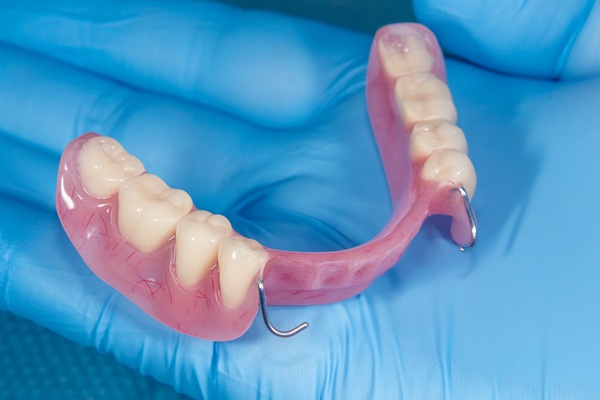 What You Need To Know About Partial Dentures