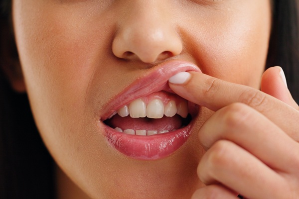 How Lasers Help Treat Gum Disease