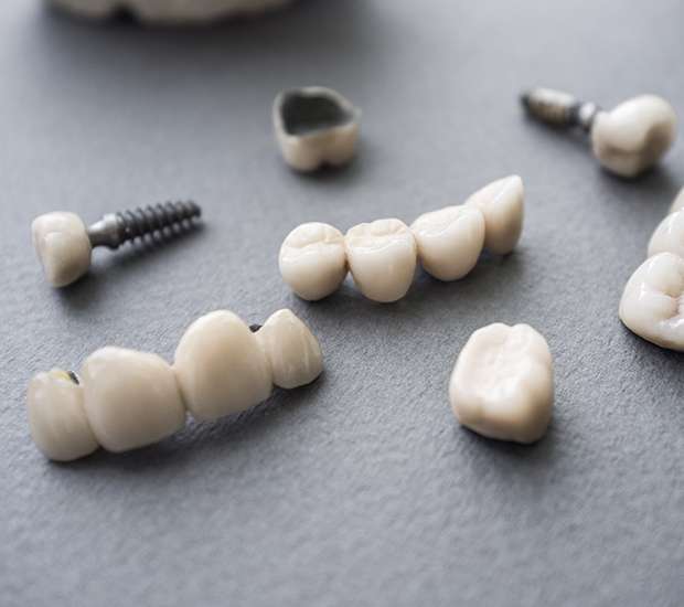 Oakland The Difference Between Dental Implants and Mini Dental Implants
