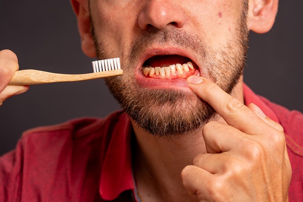 Periodontics: The Key To Healthy Gums And A Strong Foundation For Your Teeth
