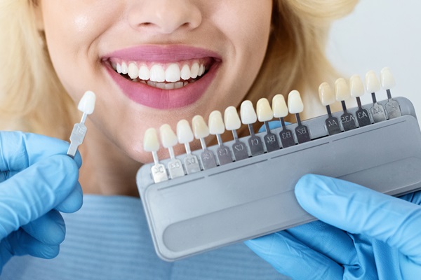 How Veneers Can Improve Teeth Appearance